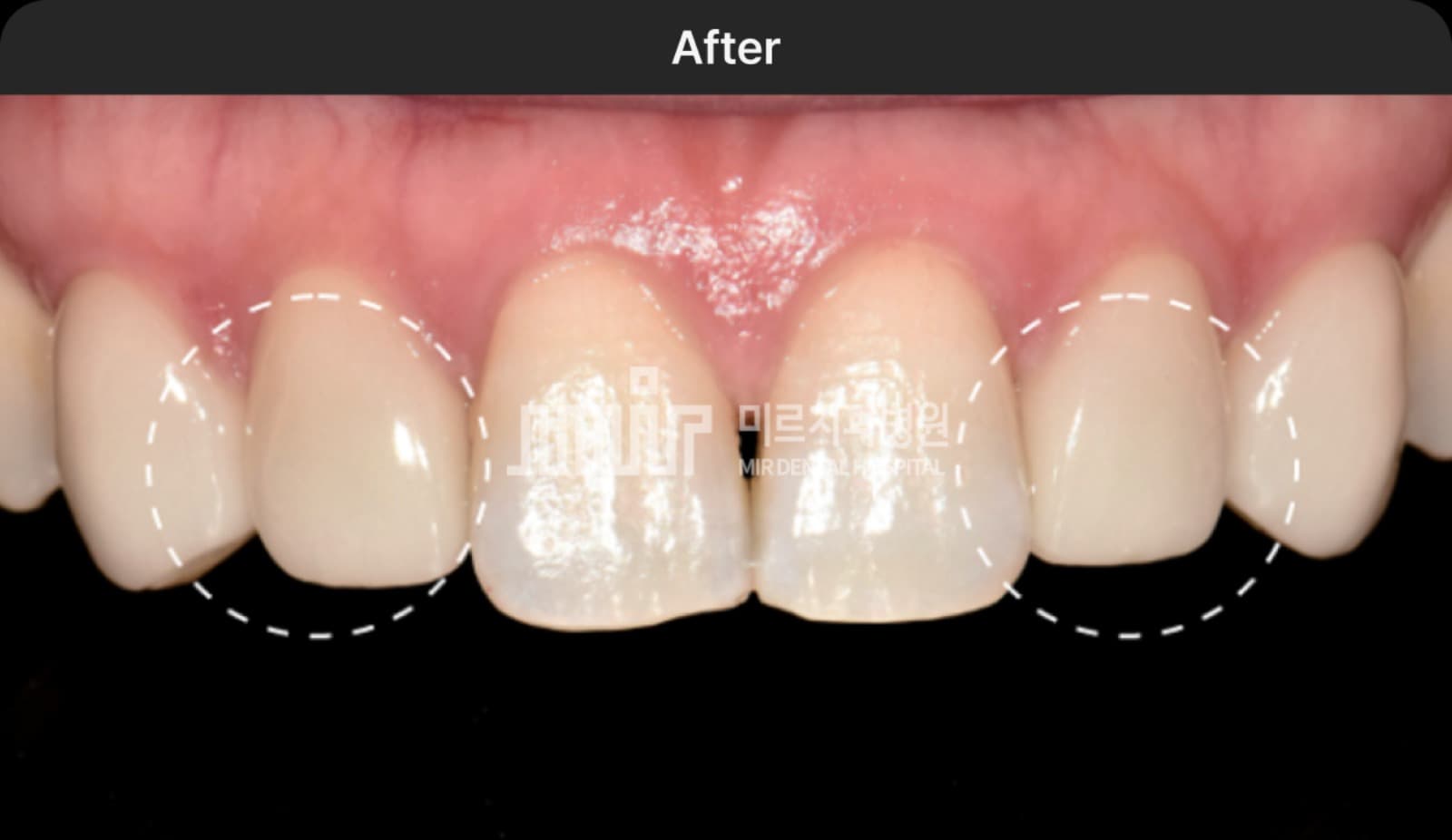 2-2-2.png