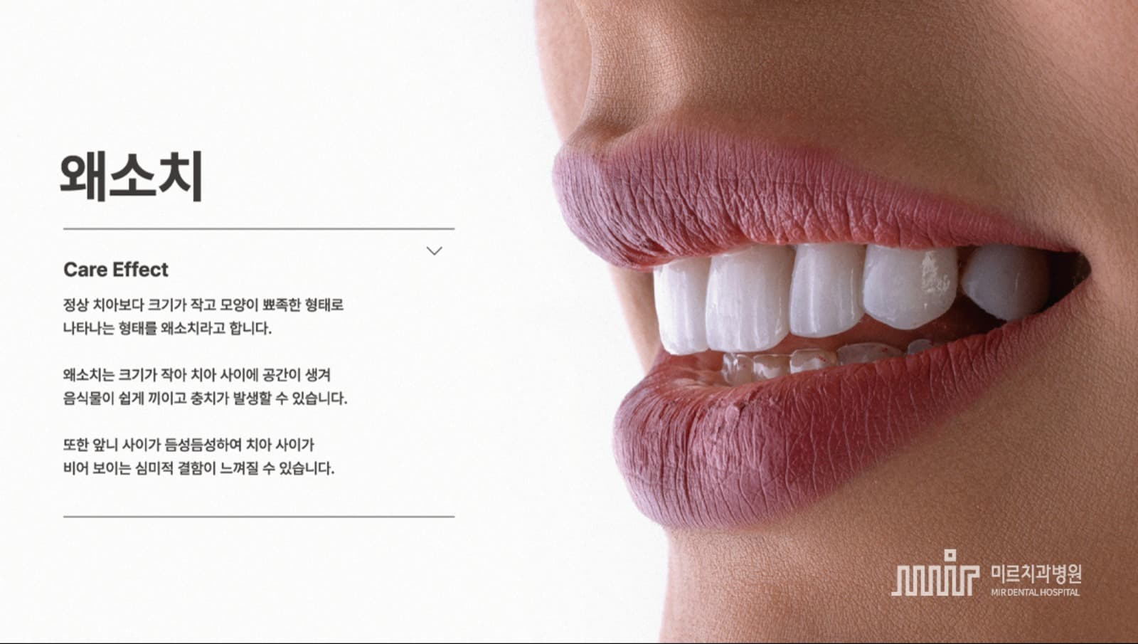 왜소치(수정).png