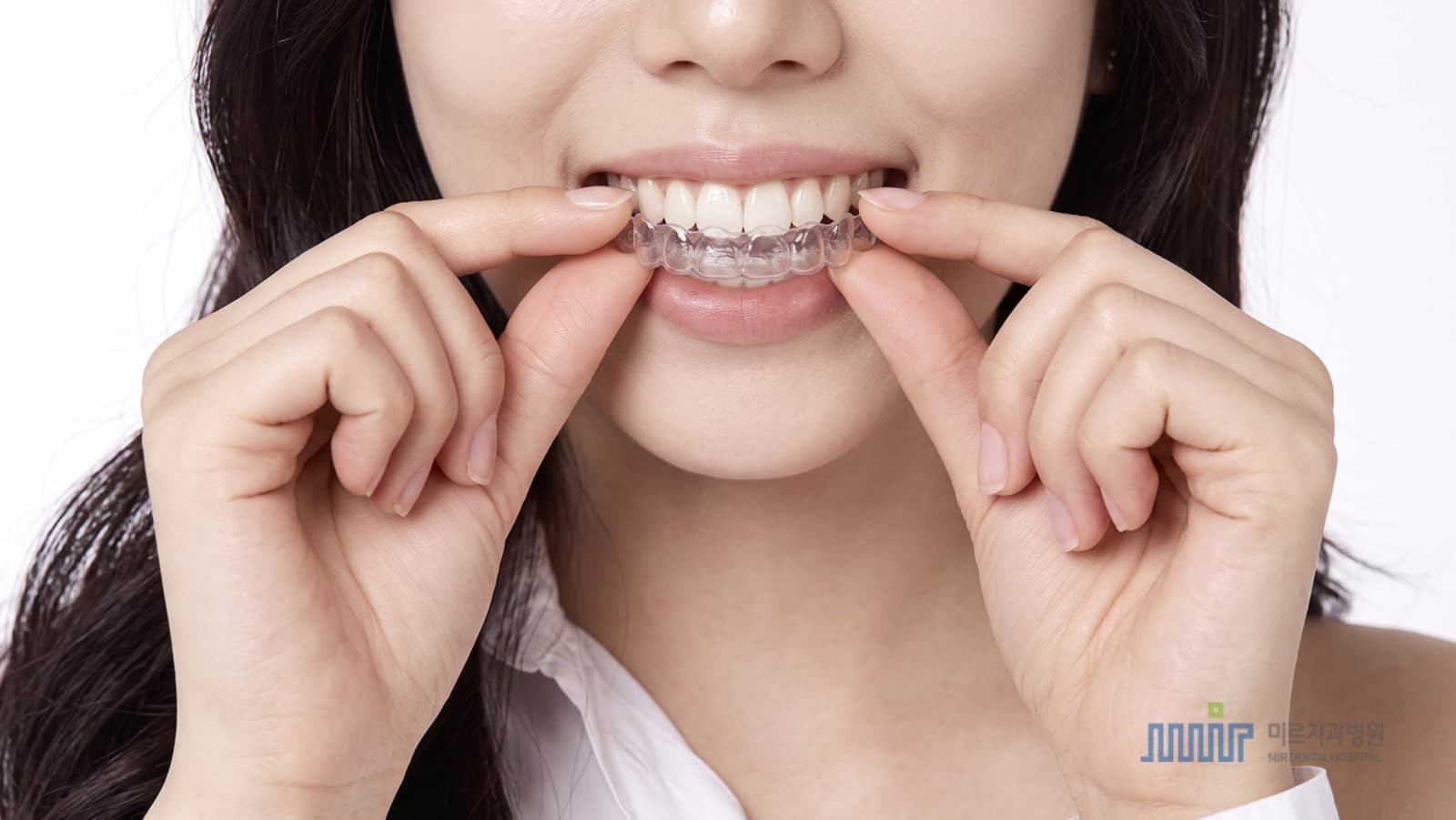 유지장치 비용, 어떤 기준으로 물어보면 좋을까요_.png