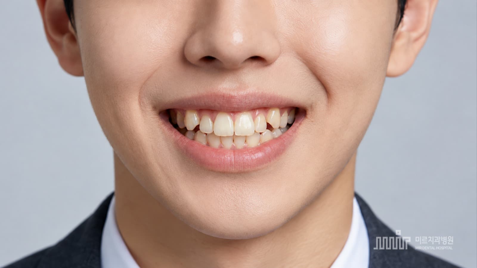 교정 전과 교정 중에는 무엇을 챙기나요.png